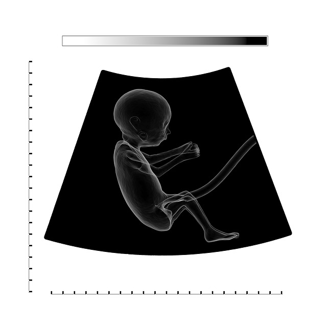 Connaître le sexe du bébé à la première échographie